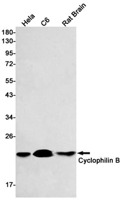 Invitrogen Cyclophilin B Recombinant Rabbit Monoclonal Antibody (K01_1Q06) 100 &mu;L | Buy Online | Invitrogen&trade; | Fisher Scientific