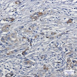 Invitrogen MYO1B Recombinant Rabbit Monoclonal Antibody (K01_1U37) 100 &mu;L | Buy Online | Invitrogen&trade; | Fisher Scientific
