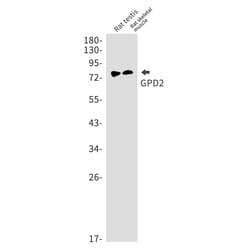 Invitrogen GPD2 Recombinant Rabbit Monoclonal Antibody (K01_1R91) 100 &mu;L | Buy Online | Invitrogen&trade; | Fisher Scientific
