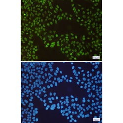 Invitrogen SP1 Recombinant Rabbit Monoclonal Antibody (K01_1Y67) 50 &mu;L | Buy Online | Invitrogen&trade; | Fisher Scientific