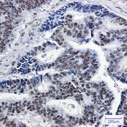 Invitrogen SP1 Recombinant Rabbit Monoclonal Antibody (K01_1Y67) 50 &mu;L | Buy Online | Invitrogen&trade; | Fisher Scientific