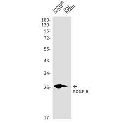 Invitrogen PDGF-B Recombinant Rabbit Monoclonal Antibody (K01_1W47) 50 &mu;L | Buy Online | Invitrogen&trade; | Fisher Scientific