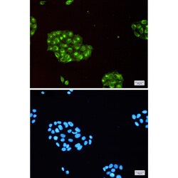 Invitrogen IFITM3 Recombinant Rabbit Monoclonal Antibody (K01_1R35) 100 &mu;L | Buy Online | Invitrogen&trade; | Fisher Scientific