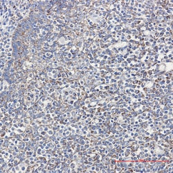 Invitrogen Cyclophilin F Recombinant Rabbit Monoclonal Antibody (K01_1Q07) 50 &mu;L | Buy Online | Invitrogen&trade; | Fisher Scientific