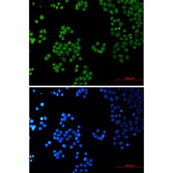 Invitrogen SP1 Recombinant Rabbit Monoclonal Antibody (K01_1Y66) 50 &mu;L | Buy Online | Invitrogen&trade; | Fisher Scientific