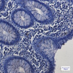Invitrogen SP1 Recombinant Rabbit Monoclonal Antibody (K01_1Y66) 50 &mu;L | Buy Online | Invitrogen&trade; | Fisher Scientific