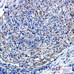 Invitrogen PRMT3 Recombinant Rabbit Monoclonal Antibody (K01_1X11) 100 &mu;L | Buy Online | Invitrogen&trade; | Fisher Scientific
