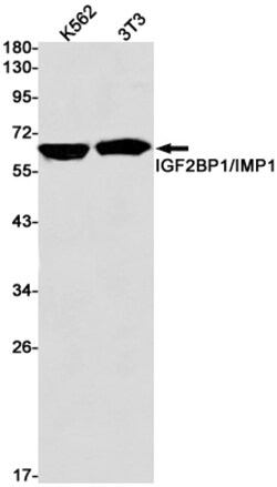 Invitrogen IGF2BP1 Recombinant Rabbit Monoclonal Antibody (K01_1S71) 50 &mu;L | Buy Online | Invitrogen&trade; | Fisher Scientific