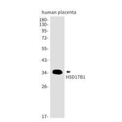 Invitrogen HSD17B1 Recombinant Rabbit Monoclonal Antibody (K01_1S53) 50 &mu;L | Buy Online | Invitrogen&trade; | Fisher Scientific