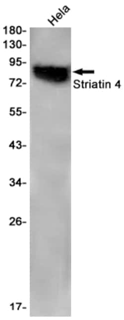 Invitrogen STRN4 Recombinant Rabbit Monoclonal Antibody (K01_1Y83) 50 &mu;L | Buy Online | Invitrogen&trade; | Fisher Scientific