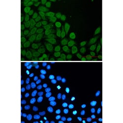 Invitrogen eIF4A3 Recombinant Rabbit Monoclonal Antibody (K01_1Q69) 50 &mu;L | Buy Online | Invitrogen&trade; | Fisher Scientific