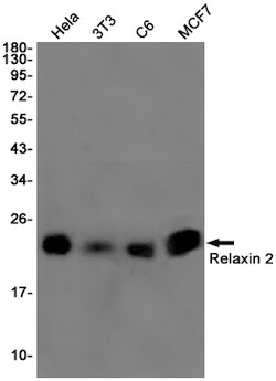 Invitrogen Relaxin 2 Recombinant Rabbit Monoclonal Antibody (K01_1X73) 50 &mu;L | Buy Online | Invitrogen&trade; | Fisher Scientific