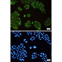 Invitrogen SCD Recombinant Rabbit Monoclonal Antibody (K01_1Y15) 100 &mu;L | Buy Online | Invitrogen&trade; | Fisher Scientific