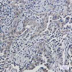 Invitrogen SCD Recombinant Rabbit Monoclonal Antibody (K01_1Y15) 100 &mu;L | Buy Online | Invitrogen&trade; | Fisher Scientific