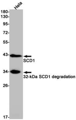 Invitrogen SCD Recombinant Rabbit Monoclonal Antibody (K01_1Y15) 100 &mu;L | Buy Online | Invitrogen&trade; | Fisher Scientific
