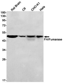 Invitrogen Fumarase Recombinant Rabbit Monoclonal Antibody (K01_1R16) 50 &mu;L | Buy Online | Invitrogen&trade; | Fisher Scientific