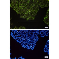 Invitrogen NFkB p100 Recombinant Rabbit Monoclonal Antibody (K01_1U76) 100 &mu;L | Buy Online | Invitrogen&trade; | Fisher Scientific