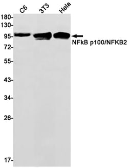 Invitrogen NFkB p100 Recombinant Rabbit Monoclonal Antibody (K01_1U76) 100 &mu;L | Buy Online | Invitrogen&trade; | Fisher Scientific