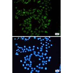 Invitrogen RAP1GAP Recombinant Rabbit Monoclonal Antibody (K01_1X59) 100 &mu;L | Buy Online | Invitrogen&trade; | Fisher Scientific