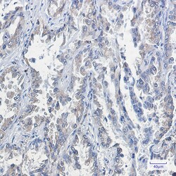 Invitrogen RAP1GAP Recombinant Rabbit Monoclonal Antibody (K01_1X59) 100 &mu;L | Buy Online | Invitrogen&trade; | Fisher Scientific