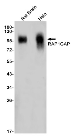 Invitrogen RAP1GAP Recombinant Rabbit Monoclonal Antibody (K01_1X59) 100 &mu;L | Buy Online | Invitrogen&trade; | Fisher Scientific