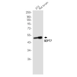 Invitrogen Septin-7 Recombinant Rabbit Monoclonal Antibody (K01_1Y25) 50 &mu;L | Buy Online | Invitrogen&trade; | Fisher Scientific