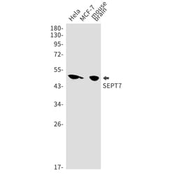 Invitrogen Septin-7 Recombinant Rabbit Monoclonal Antibody (K01_1Y25) 50 &mu;L | Buy Online | Invitrogen&trade; | Fisher Scientific
