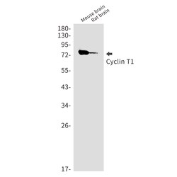 Invitrogen Cyclin T1 Recombinant Rabbit Monoclonal Antibody (K01_1Q05) 50 &mu;L | Buy Online | Invitrogen&trade; | Fisher Scientific