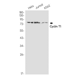 Invitrogen Cyclin T1 Recombinant Rabbit Monoclonal Antibody (K01_1Q05) 50 &mu;L | Buy Online | Invitrogen&trade; | Fisher Scientific