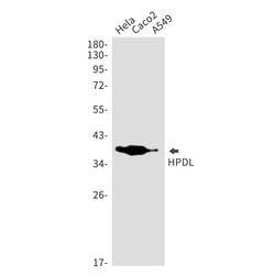 Invitrogen HPDL Recombinant Rabbit Monoclonal Antibody (K01_1S49) 50 &mu;L | Buy Online | Invitrogen&trade; | Fisher Scientific