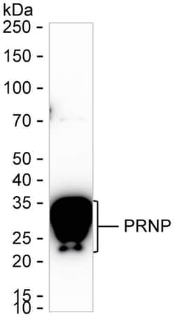 Invitrogen PrP Recombinant Rabbit Monoclonal Antibody (K01_1X09) 50 &mu;L | Buy Online | Invitrogen&trade; | Fisher Scientific