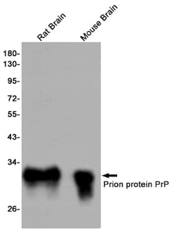 Invitrogen PrP Recombinant Rabbit Monoclonal Antibody (K01_1X09) 50 &mu;L | Buy Online | Invitrogen&trade; | Fisher Scientific