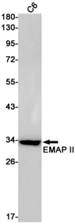 Invitrogen EMAP II Recombinant Rabbit Monoclonal Antibody (K01_1Q76) 100 &mu;L | Buy Online | Invitrogen&trade; | Fisher Scientific