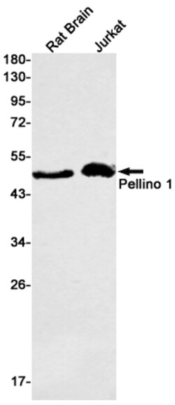 Invitrogen Pellino 1 Recombinant Rabbit Monoclonal Antibody (K01_1W56) 100 &mu;L | Buy Online | Invitrogen&trade; | Fisher Scientific