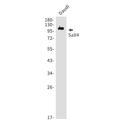 Invitrogen SALL4 Recombinant Rabbit Monoclonal Antibody (K01_1Y08) 100 &mu;L | Buy Online | Invitrogen&trade; | Fisher Scientific