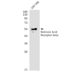 Invitrogen RARB Recombinant Rabbit Monoclonal Antibody (K01_1X75) 50 &mu;L | Buy Online | Invitrogen&trade; | Fisher Scientific