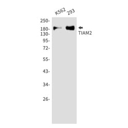 Invitrogen TIAM2 Recombinant Rabbit Monoclonal Antibody (K01_2J29) 100 &mu;L | Buy Online | Invitrogen&trade; | Fisher Scientific