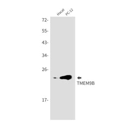 Invitrogen TMEM9B Recombinant Rabbit Monoclonal Antibody (K01_2J39) 100 &mu;L | Buy Online | Invitrogen&trade; | Fisher Scientific
