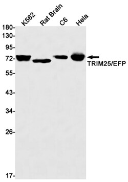 Invitrogen TRIM25 Recombinant Rabbit Monoclonal Antibody (K01_2J58) 100 &mu;L | Buy Online | Invitrogen&trade; | Fisher Scientific