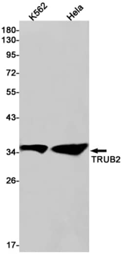 Invitrogen TRUB2 Recombinant Rabbit Monoclonal Antibody (K01_2J62) 100 &mu;L | Buy Online | Invitrogen&trade; | Fisher Scientific