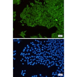 Invitrogen TrxR1 Recombinant Rabbit Monoclonal Antibody (K01_2J71) 50 &mu;L | Buy Online | Invitrogen&trade; | Fisher Scientific