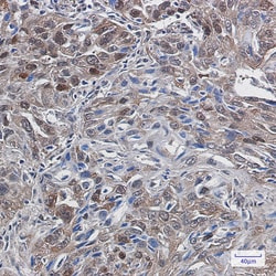 Invitrogen TrxR1 Recombinant Rabbit Monoclonal Antibody (K01_2J71) 50 &mu;L | Buy Online | Invitrogen&trade; | Fisher Scientific