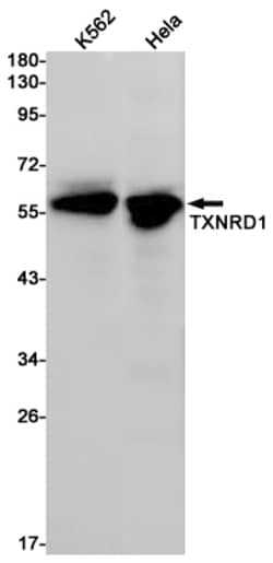 Invitrogen TrxR1 Recombinant Rabbit Monoclonal Antibody (K01_2J71) 50 &mu;L | Buy Online | Invitrogen&trade; | Fisher Scientific
