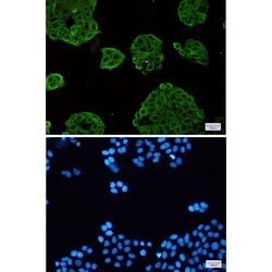 Invitrogen VPS4A Recombinant Rabbit Monoclonal Antibody (K01_2K09) 50 &mu;L | Buy Online | Invitrogen&trade; | Fisher Scientific