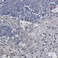 Invitrogen VPS4A Recombinant Rabbit Monoclonal Antibody (K01_2K09) 50 &mu;L | Buy Online | Invitrogen&trade; | Fisher Scientific