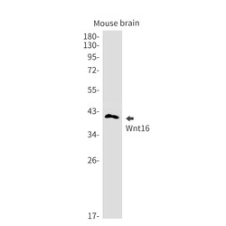 Invitrogen WNT16 Recombinant Rabbit Monoclonal Antibody (K01_2K13) 100 &mu;L | Buy Online | Invitrogen&trade; | Fisher Scientific