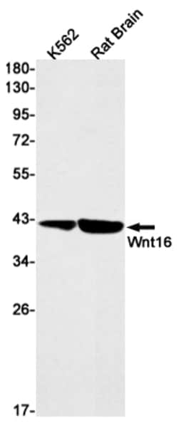 Invitrogen WNT16 Recombinant Rabbit Monoclonal Antibody (K01_2K13) 100 &mu;L | Buy Online | Invitrogen&trade; | Fisher Scientific