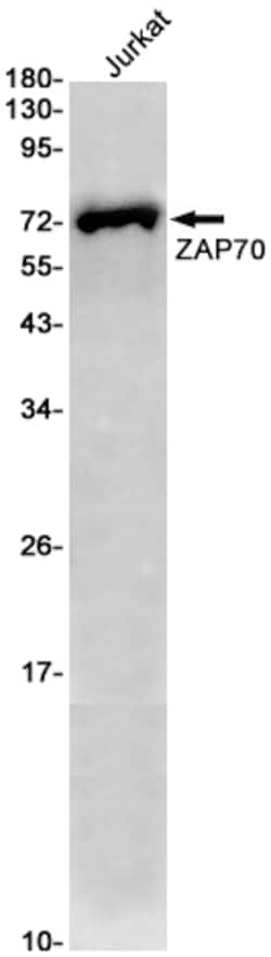 Invitrogen Zap-70 Recombinant Rabbit Monoclonal Antibody (K01_2K28) 100 &mu;L | Buy Online | Invitrogen&trade; | Fisher Scientific