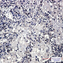 Invitrogen Zyxin Recombinant Rabbit Monoclonal Antibody (K01_2K31) 100 &mu;L | Buy Online | Invitrogen&trade; | Fisher Scientific