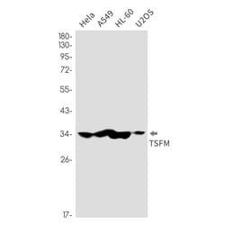 Invitrogen TSFM Recombinant Rabbit Monoclonal Antibody (K01_2K58) 100 &mu;L | Buy Online | Invitrogen&trade; | Fisher Scientific